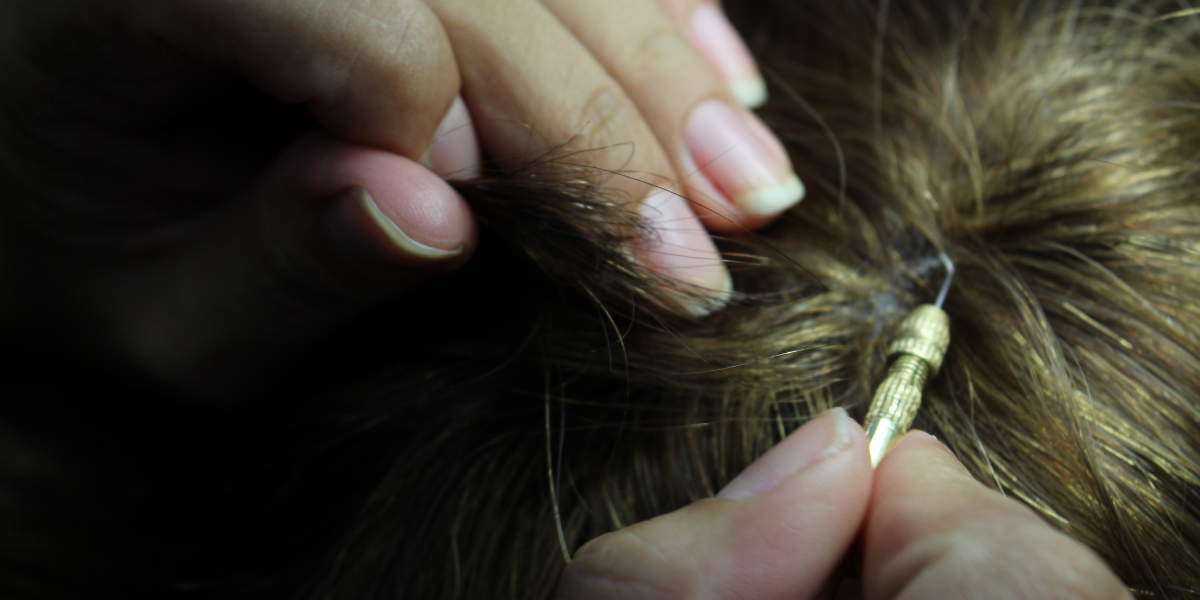 protesis capilares a medida